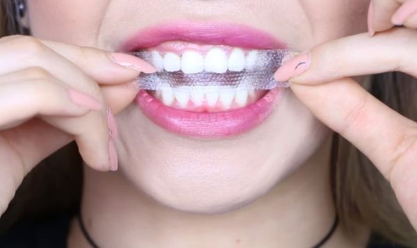 cách tẩy trăng răng tại nhà