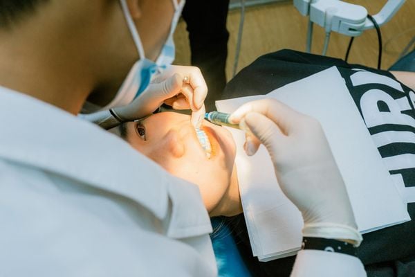 Chi phí niềng răng