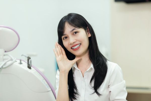 Chi phí niềng răng