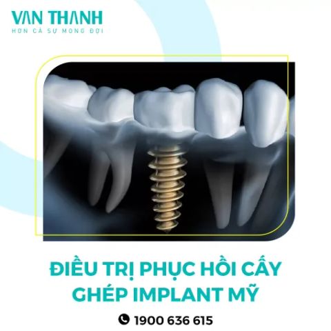 Điều trị 3