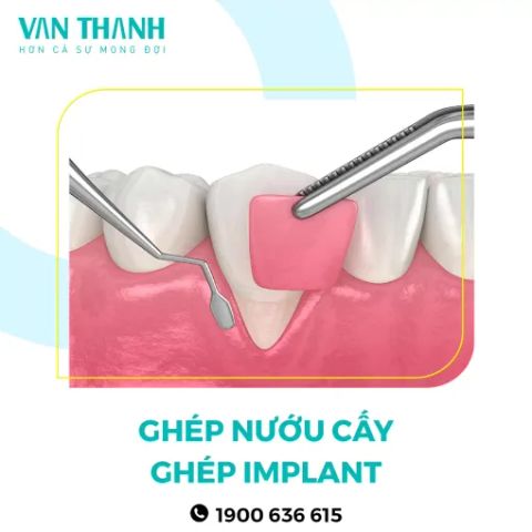 Giải pháp 1
