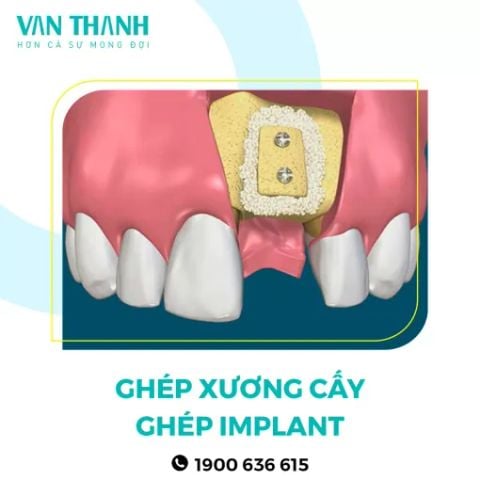 Giải pháp 2