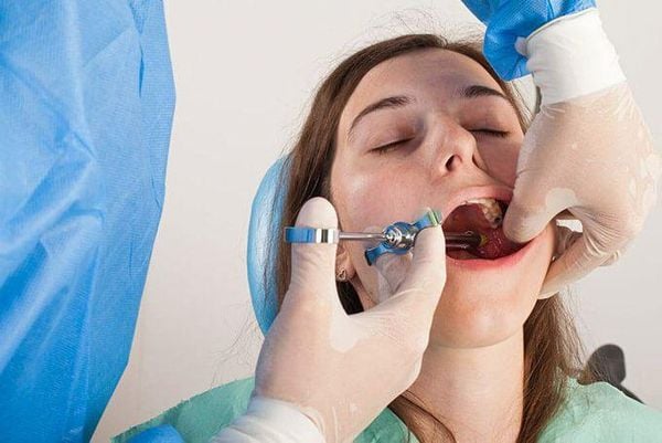 nhổ răng khôn mọc lệch có đau không