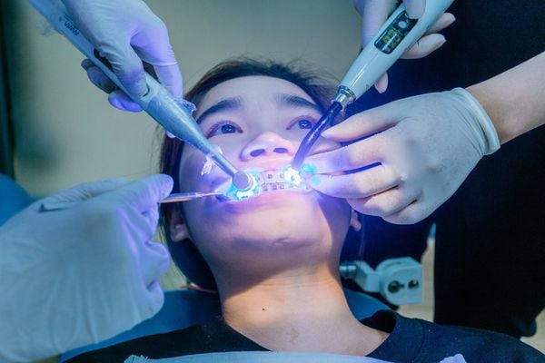 niềng răng là gì - quy trình niềng răng