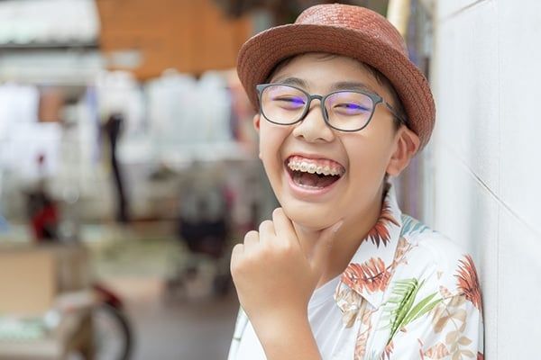 Niềng răng trẻ em