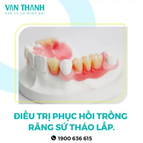 Điều trị 17