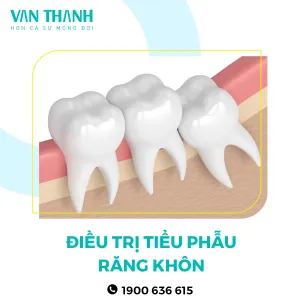 Điều trị 9