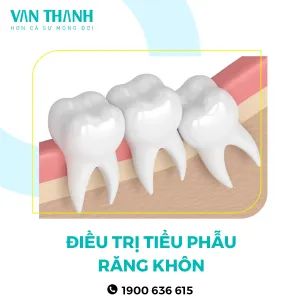 Điều trị 9