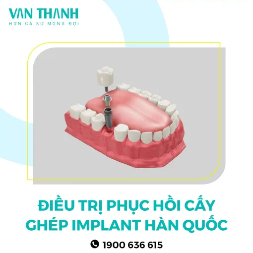 Điều trị 2