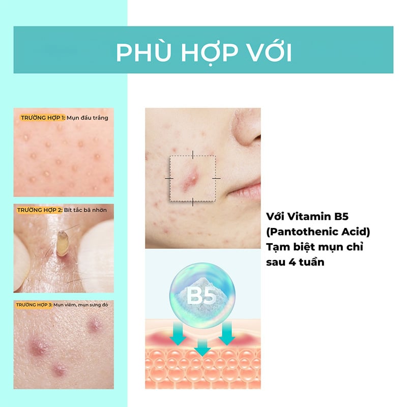 thegioiskinfood.com - Kem Dưỡng Làm Dịu Da, Hỗ Trợ Phục Hồi Da numbuzin No.1 Pantothenic B5 Active Soothing Cream 80ml