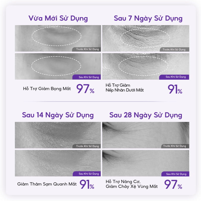 thegioiskinfood.com - Kem Dưỡng Mắt Hỗ Trợ Dưỡng Sáng & Nâng Cơ Vùng Da Mắt Colorkey Luminous Ginseng Brightening & Uplifting Eye Cream 20ml