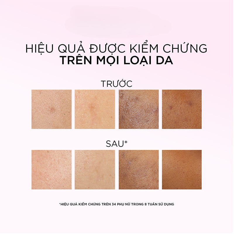 thegioiskinfood.com - Dưỡng Chất Peel Sáng Da Làm Sạch Tế Bào Chết L'Oreal Glycolic-Bright Anti-Dark Spot Exfoliant Peel 25ml