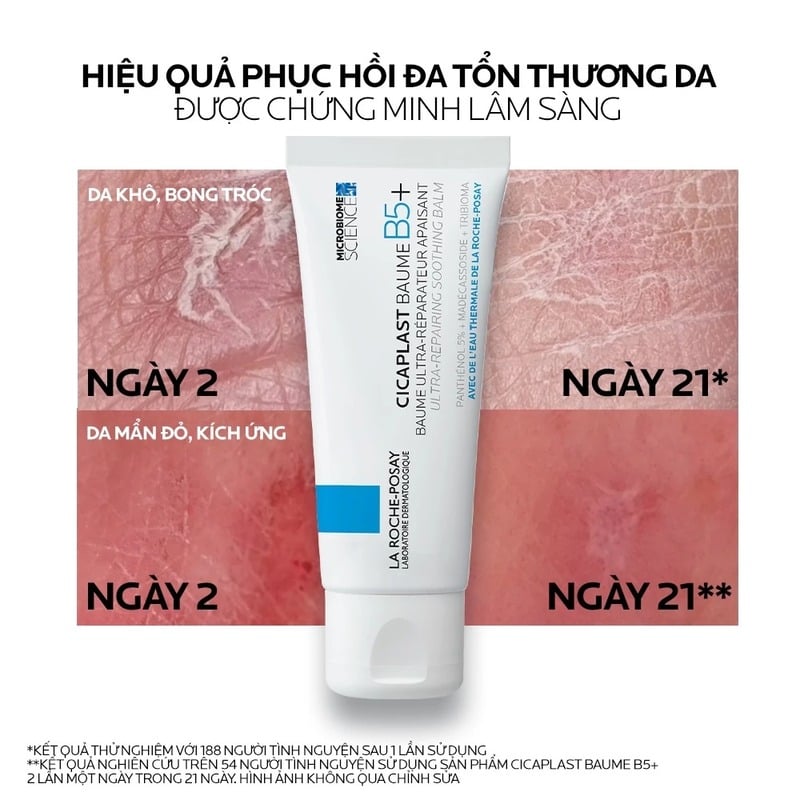 thegioiskinfood.com - Kem Dưỡng La Roche-Posay Làm Dịu, Hỗ Trợ Phục Hồi Da, Đa Công Dụng Laboratoire Dermatologique Cicaplast Baume B5+