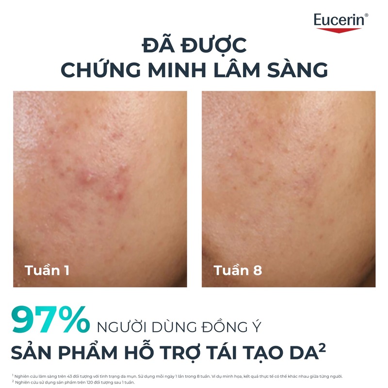 thegioiskinfood.com - Tinh Chất Eucerin Hỗ Trợ Giảm Mụn, Mờ Vết Thâm Eucerin Dermopure Clinical Peeling 10 40ml