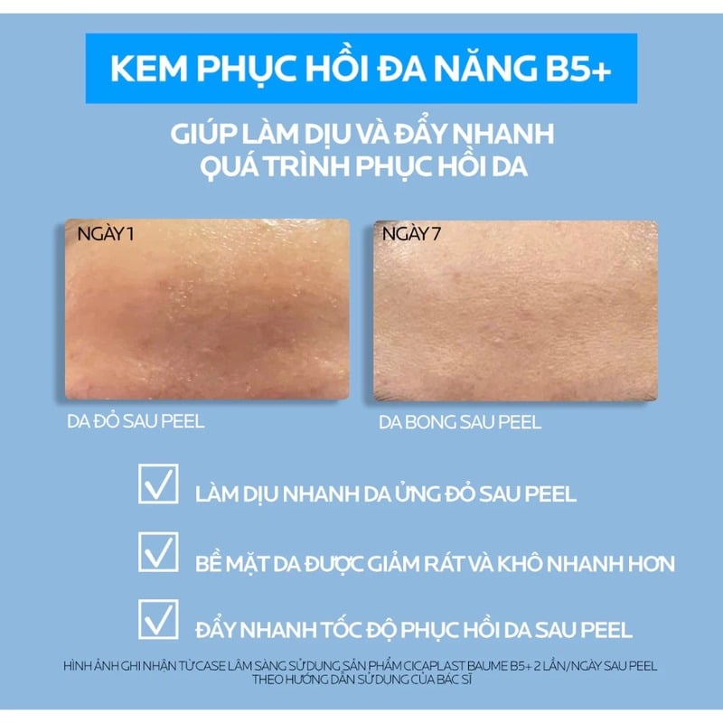 thegioiskinfood.com - Kem Dưỡng La Roche-Posay Làm Dịu, Hỗ Trợ Phục Hồi Da, Đa Công Dụng Laboratoire Dermatologique Cicaplast Baume B5+