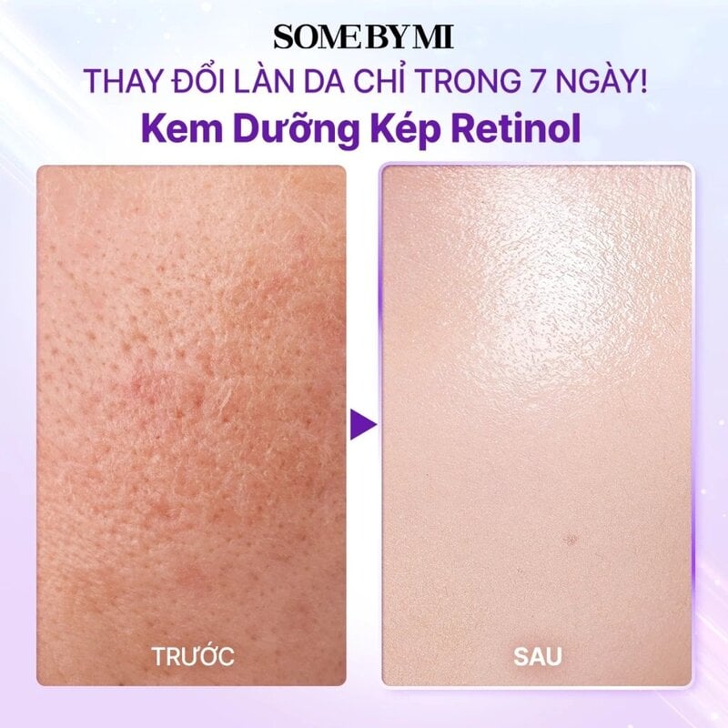 Kem Dưỡng Some By Mi Retinol Bakuchiol Dual Cream 50ml