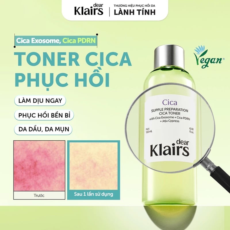 Nước Hoa Hồng Làm Dịu, Hỗ Trợ Phục Hồi Da Dear Klairs Supple Preparation Cica Toner 180ml