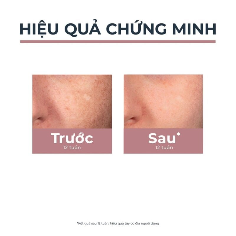Sữa Rửa Mặt Eucerin Hỗ Trợ Làm Sáng Da Spotless Brightening Amino Cleansing Foam