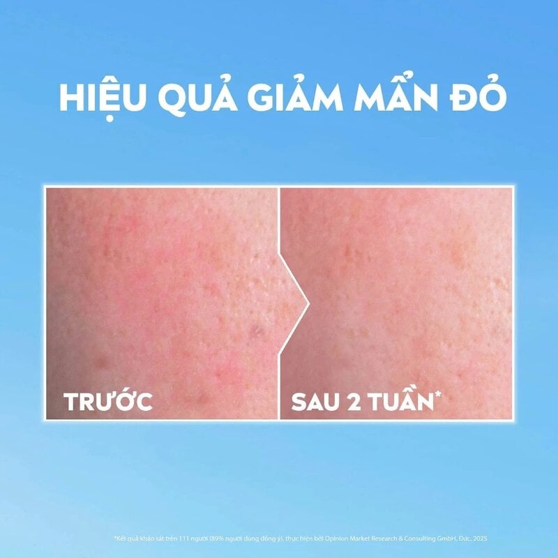 Nước Tẩy Trang Dịu Nhẹ&nbsp;Nivea Micellar Water Soothing 400ml