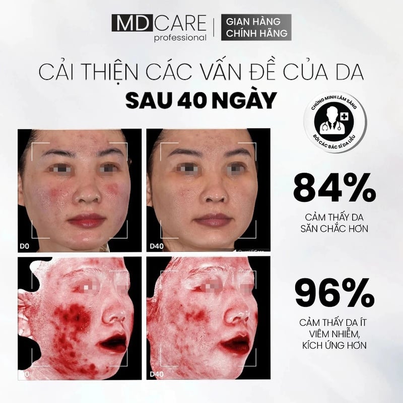 Serum Hỗ Trơ Cân Bằng Lợi Khuẩn & Hỗ Trợ Phục Hồi Da MD CARE Professional NMF Prebiotics Serum Refined Improvement Formula 30ml