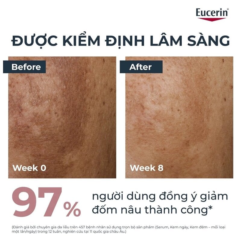 Kem Dưỡng Eucerin Ban Đêm Hỗ Trợ Giảm Thâm Nám & Làm Sáng Da Eucerin Even Skin Spotless Brightening Night 50ml