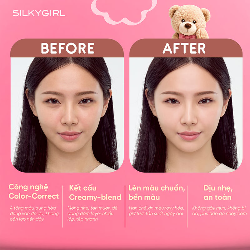Bảng Che Khuyết Điểm Đa Năng 4 Ô Silkygirl Fix It Concealer Palette 7.2g #01 Undercover