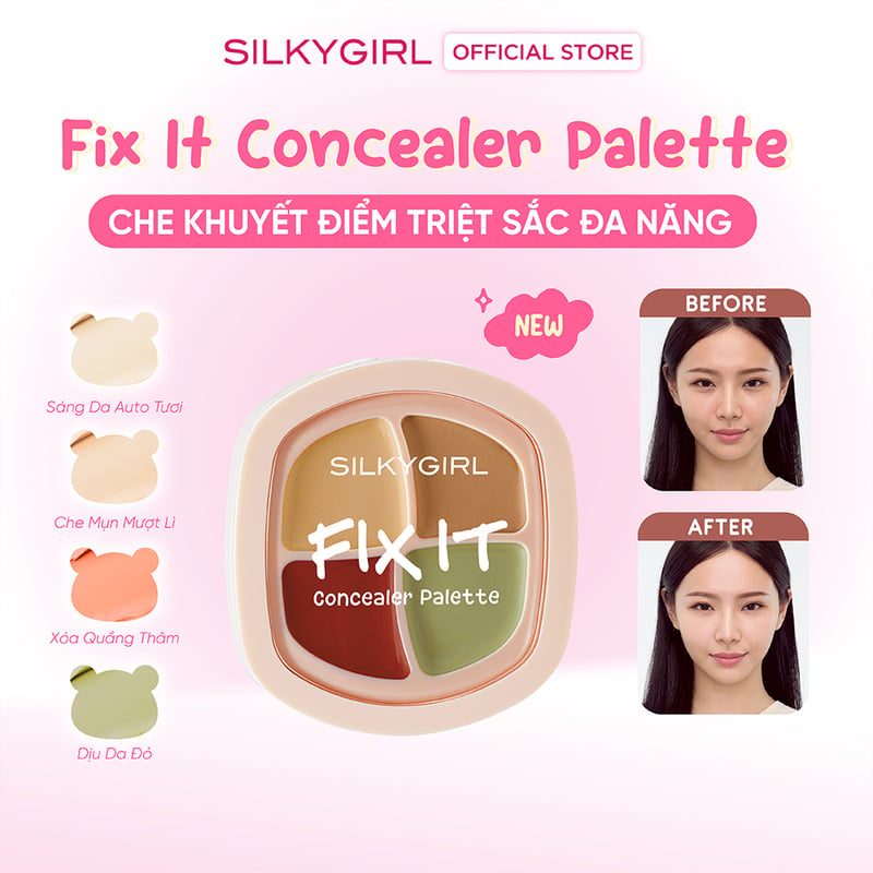 Bảng Che Khuyết Điểm Đa Năng 4 Ô Silkygirl Fix It Concealer Palette 7.2g #01 Undercover