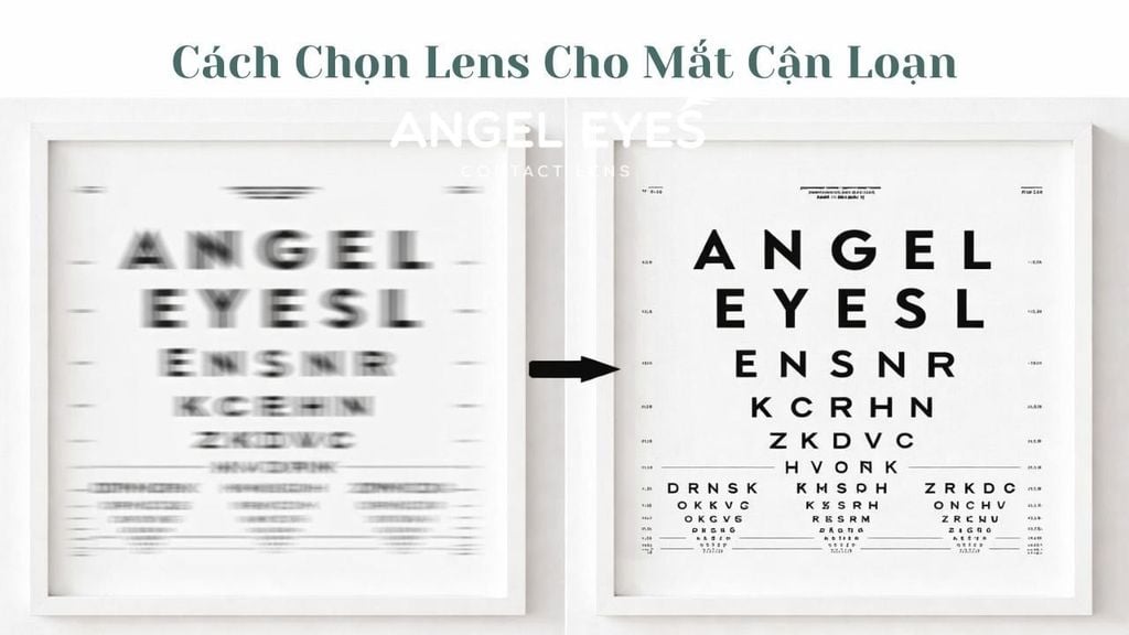 Cách Chọn Lens Cho Mắt Cận Loạn Phù Hợp Nhất