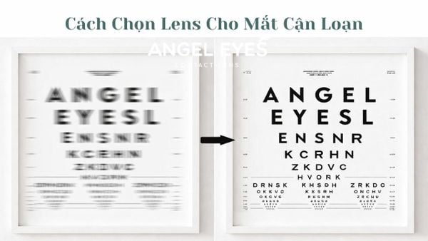 Cách Chọn Lens Cho Mắt Cận Loạn Phù Hợp Nhất