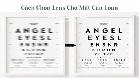 Cách Chọn Lens Cho Mắt Cận Loạn Phù Hợp Nhất