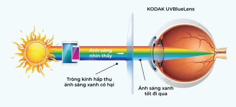 Tròng Kính Siêu Mỏng Chống Ánh Sáng Xanh KODAK UVBlue Lens 1.74