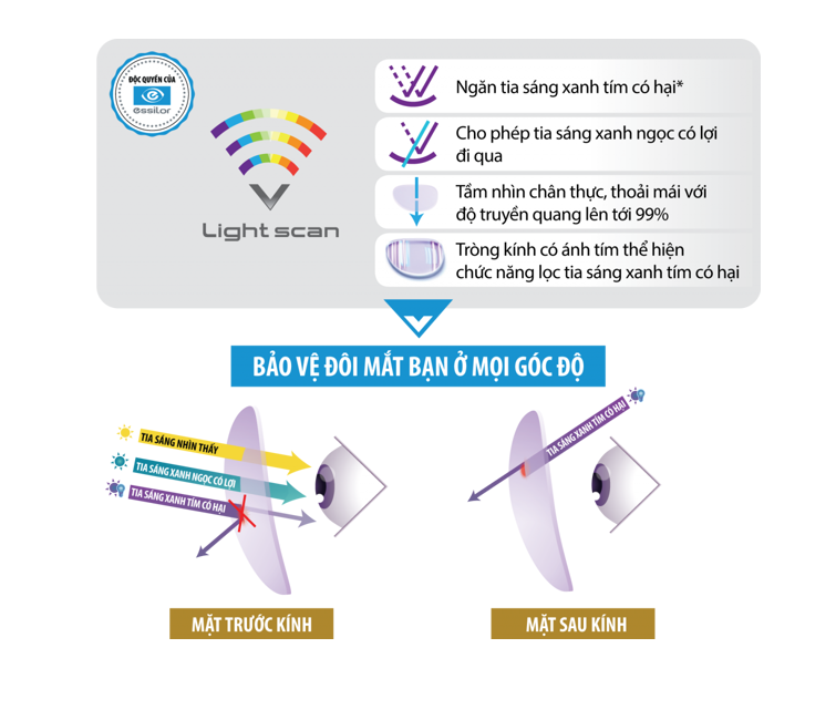 Tròng Kính Kiểm Soát Tiến Triển Cận Thị Essilor® Stellest™ 2.0