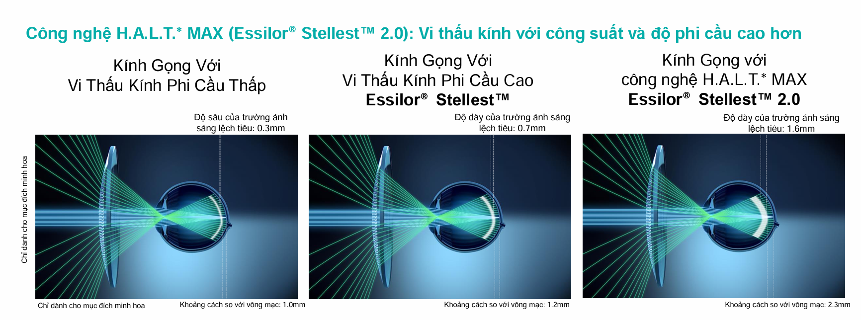Tròng Kính Kiểm Soát Tiến Triển Cận Thị Essilor® Stellest™ 2.0