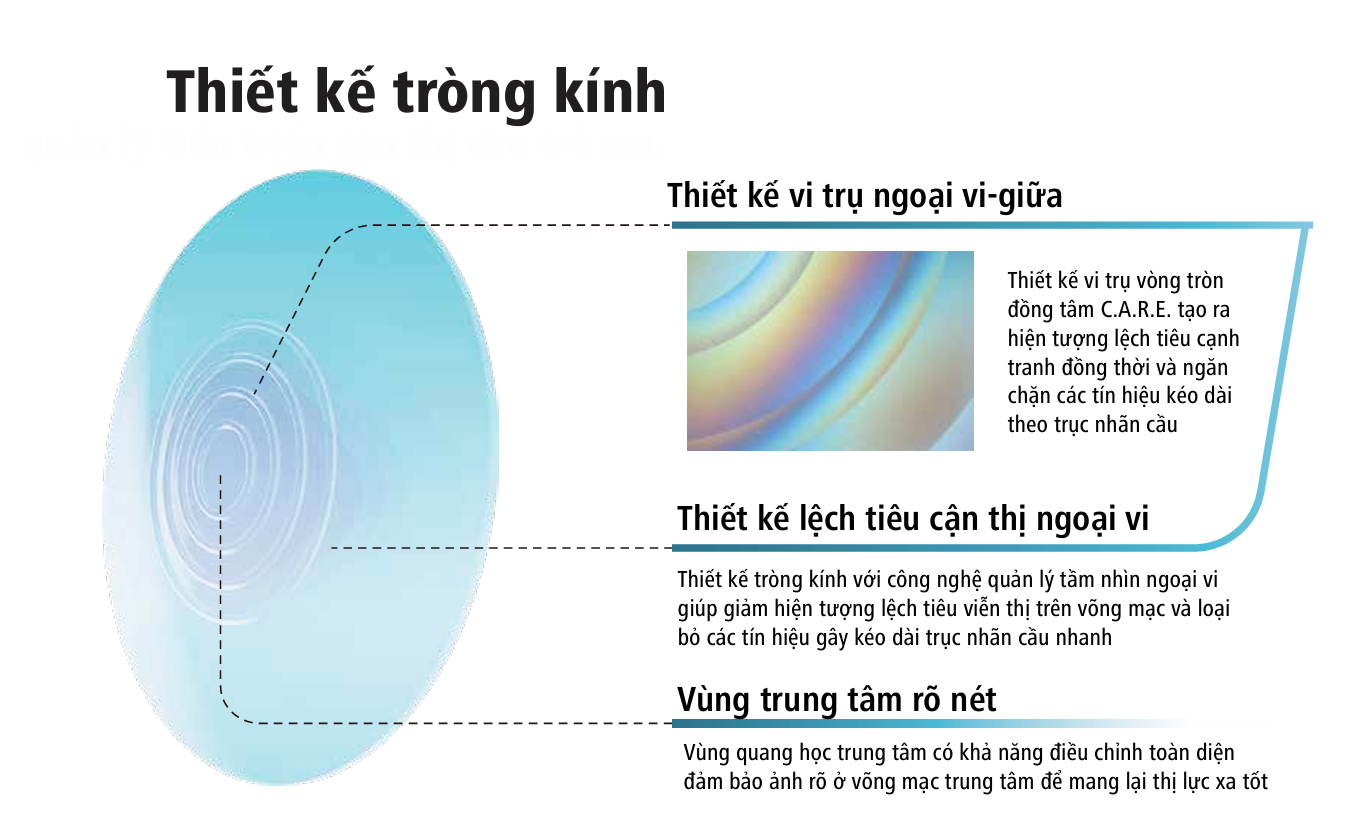Tròng Kính Kiểm Soát Tiến Triển Cận Thị Trẻ Em Zeiss MyoEase