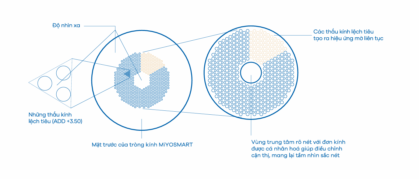 Tròng Kính Kiểm Soát Tiến Triển Cận Thị Trẻ Em Hoya Miyosmart Full Control 1.59