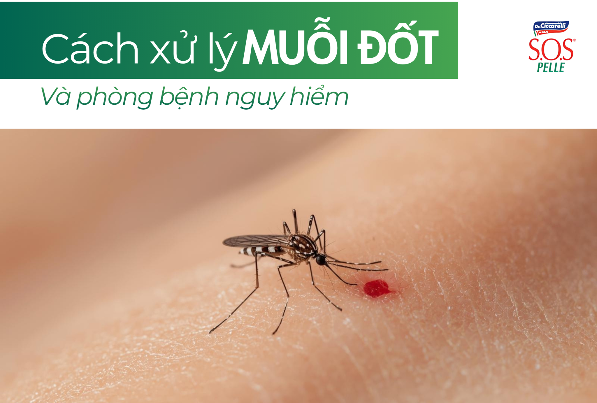 Cách xử lý muỗi đốt nhanh chóng và phòng ngừa bệnh nguy hiểm