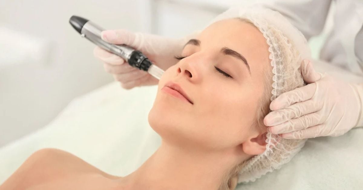 Chăm sóc da sau lăn kim tại nhà hiệu quả và đúng cách