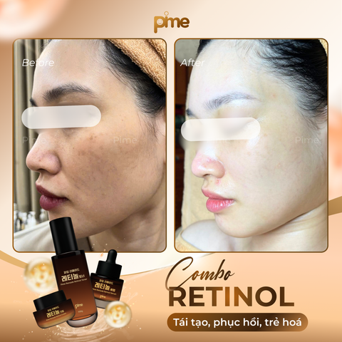 Hội chứng da “sợ” Retinol và câu chuyện phía sau Pime Remade Retinol