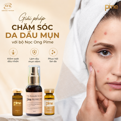 Mùa hè là "mùa cao điểm" của da mụn? Giải pháp chăm sóc da dầu mụn với bộ Nọc Ong Pime