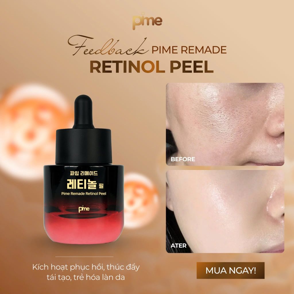 TOP 5 sai lầm thường gặp khi Peel Retinol khiến da yếu, kích ứng kéo dài