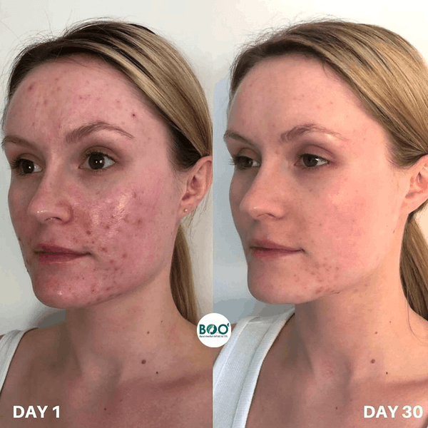 Đối tượng sử dụng Xịt kháng khuẩn, ngừa mụn, làm dịu da Clinisoothe+ Skin Purifier