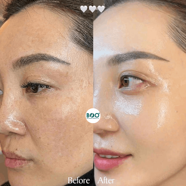 Đối tượng sử dụng KB Pure Phyto Lightening lý tưởng