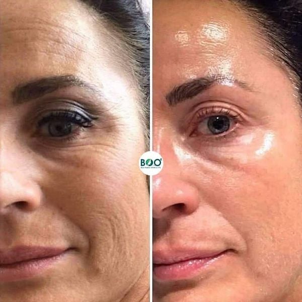 Da thường trông căng và đều màu hơn khi duy trì đều đặn