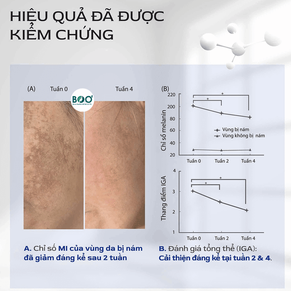 Hiệu quả làm mờ nám vượt trội của tinh chất trắng da SkinMD Pure Whitenol Serum