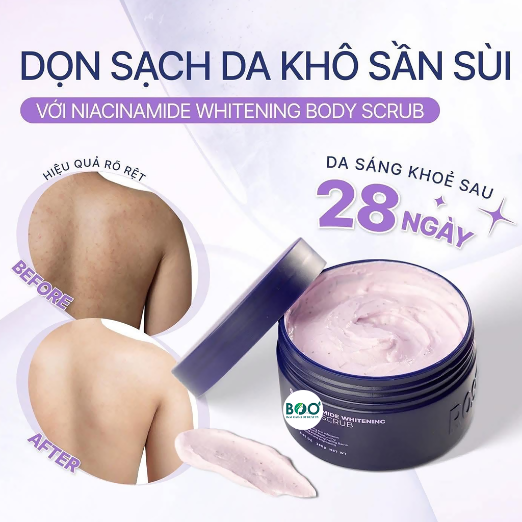 Làn da thô sần xỉn màu phù hợp dùng Tẩy da chết Rosemine