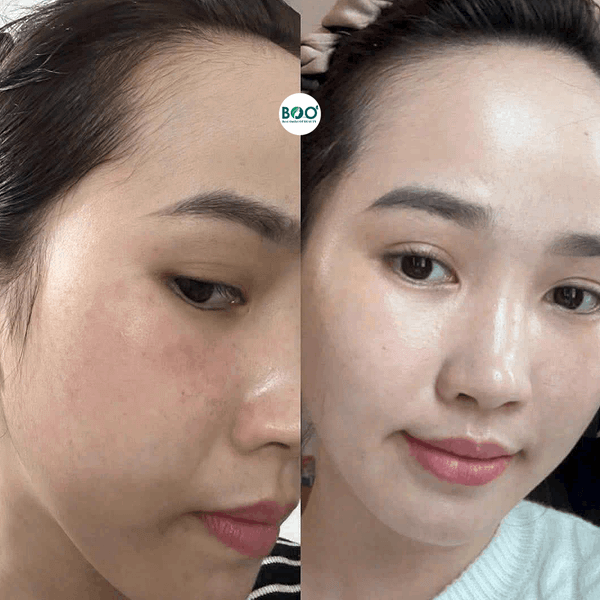 Mua Ruée chính hãng tại Chợ Tình Của Boo