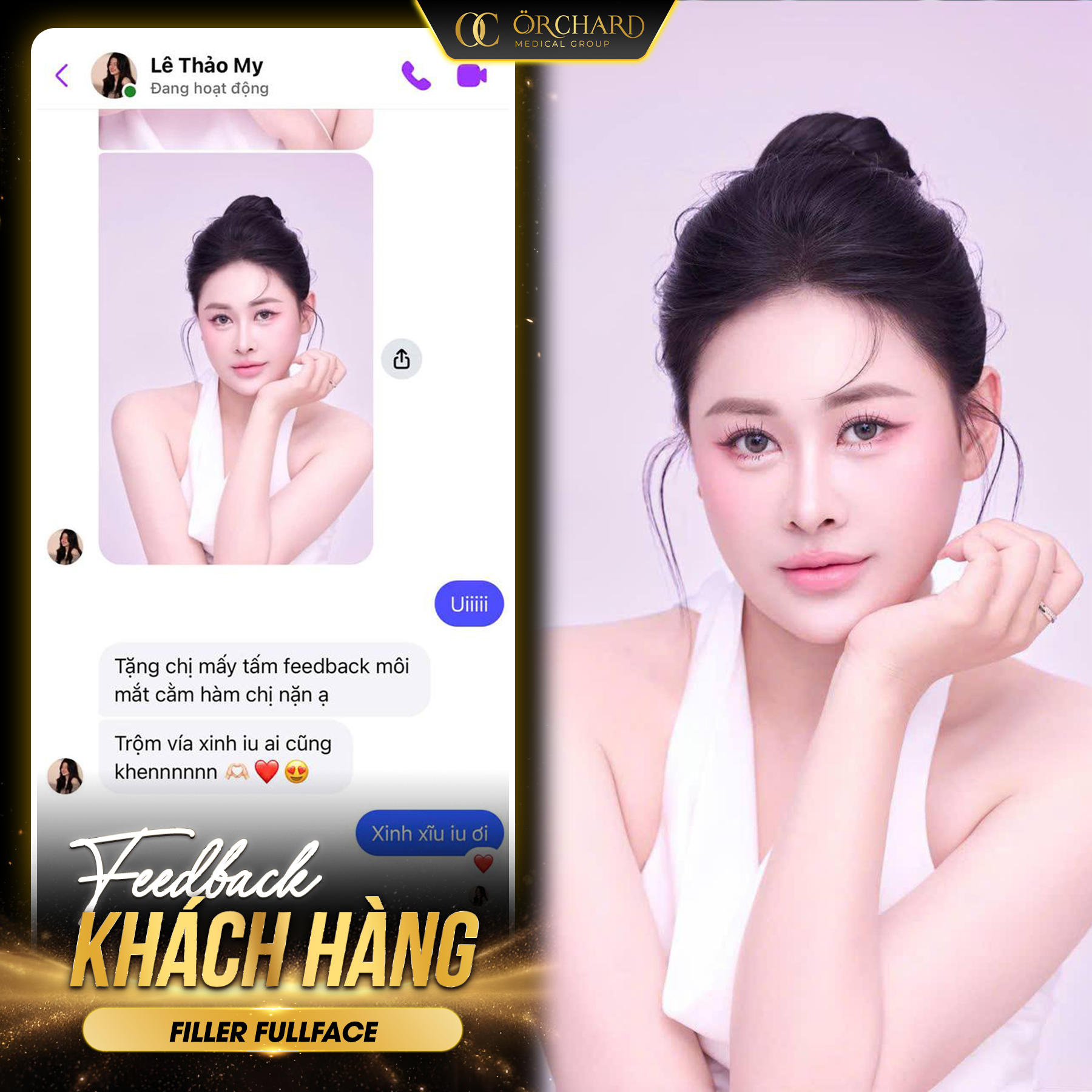 Feedback khách hàng khi tiêm filler fullface tại Orchard