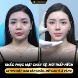 CÁC DÒNG CHỈ NÂNG CƠ ORCHARD ĐANG SỬ DỤNG