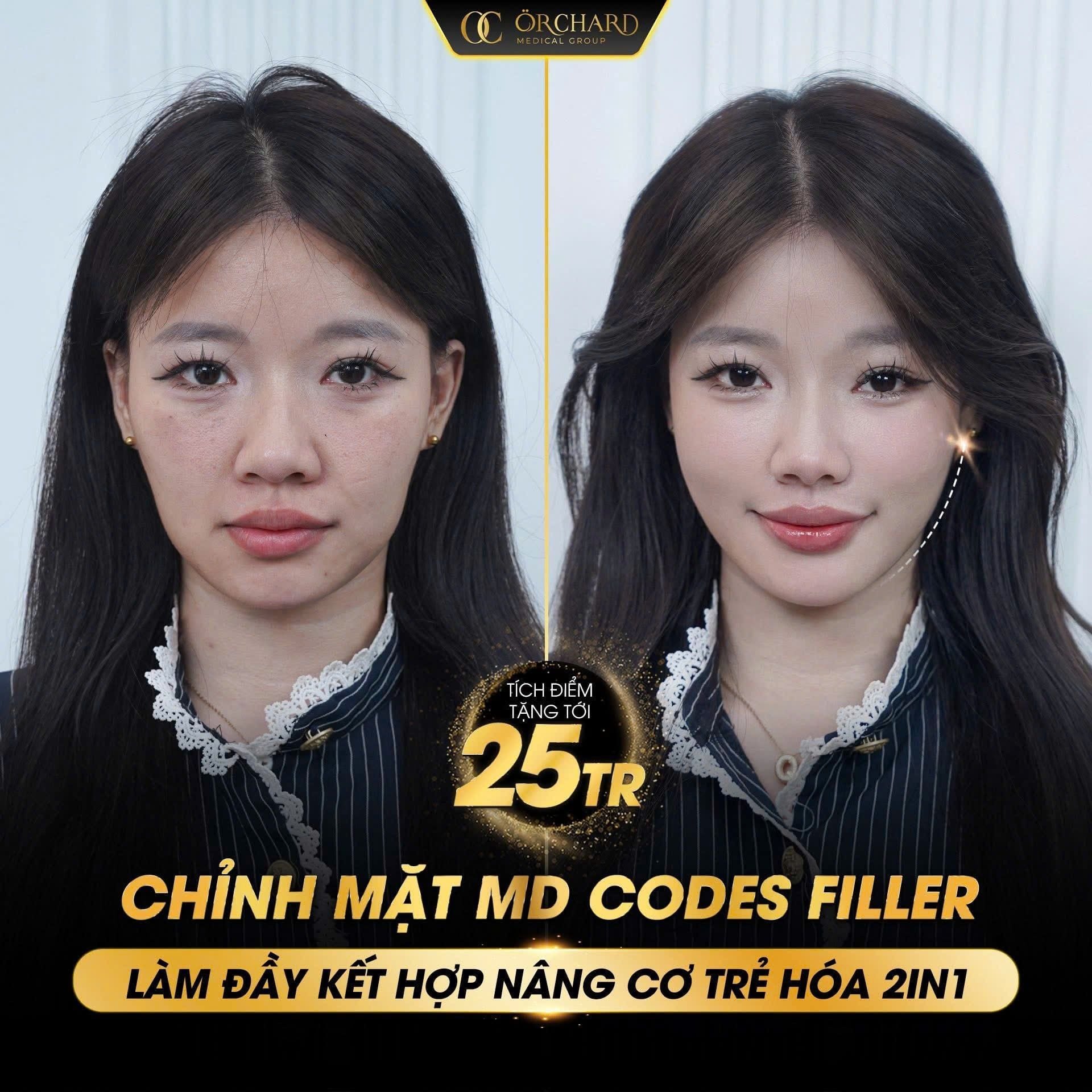 Hiệu quả của phương pháp MD CODES® trong thẩm mỹ nội khoa