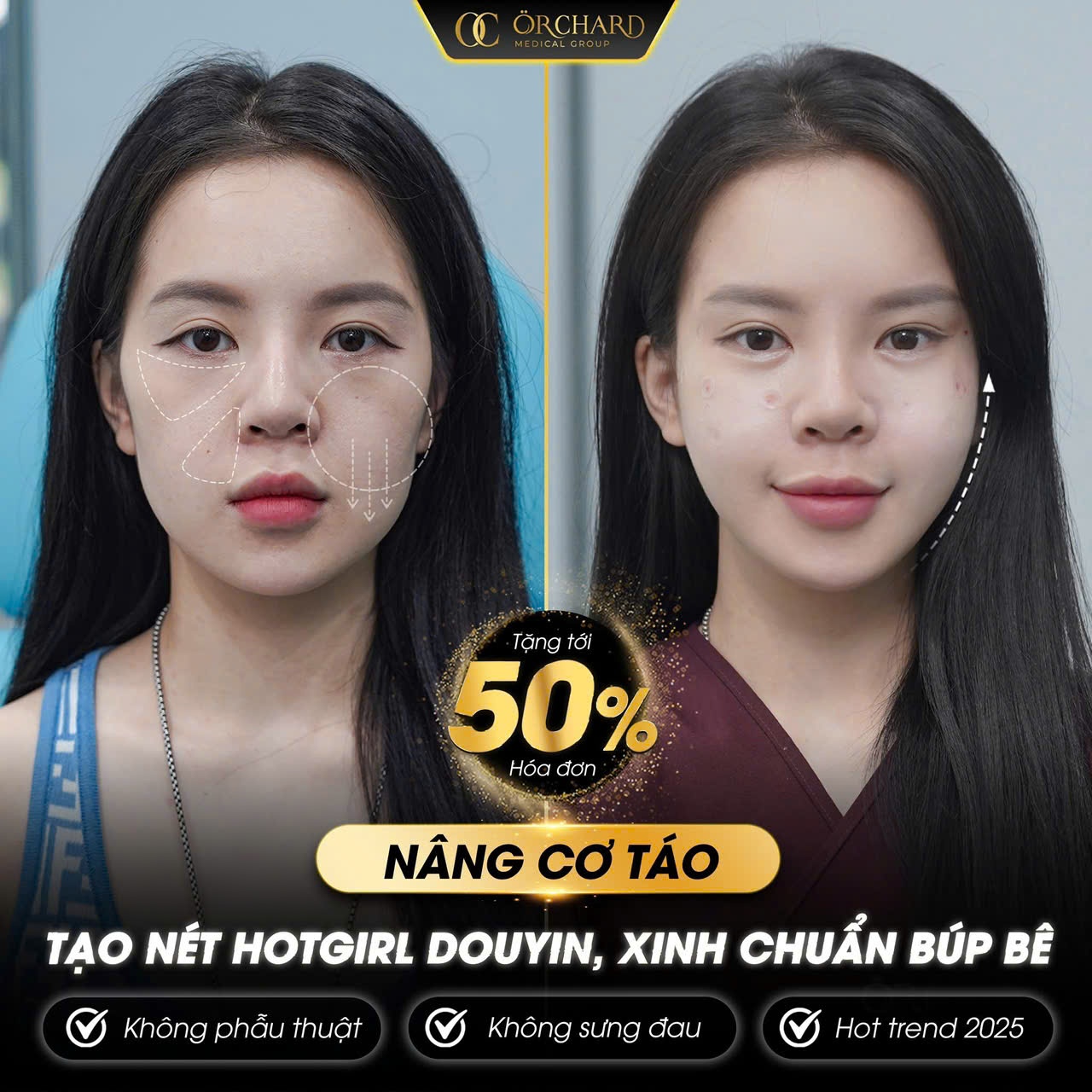 Nâng Cơ Táo – Bí Quyết Gương Mặt Chuẩn Hotgirl Douyin